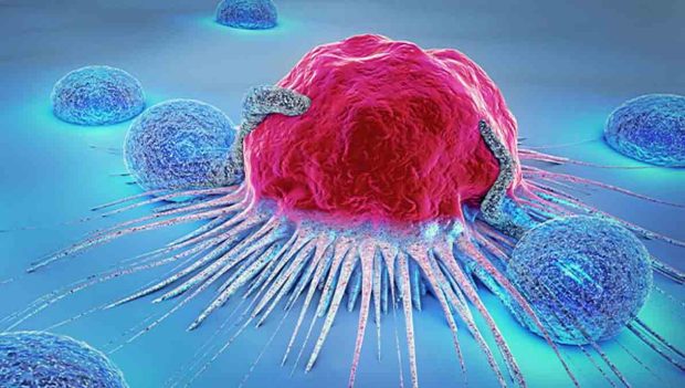 cáncer de mama detección