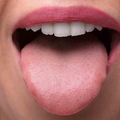 pérdida del sentido del gusto