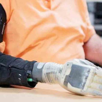 Prueban una mano de prótesis con tacto