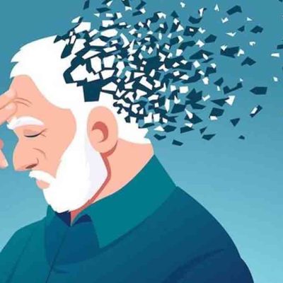 alzheimer e IA