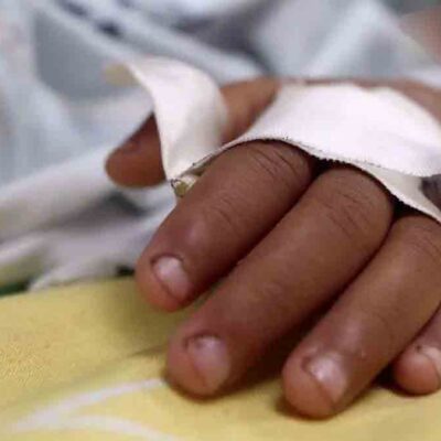 el estado de salud de la niña con rabia humana es crítico