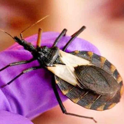 estudio de chagas